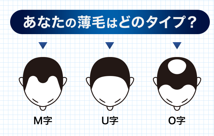 チャップアップ口コミ・評判5つのメリット