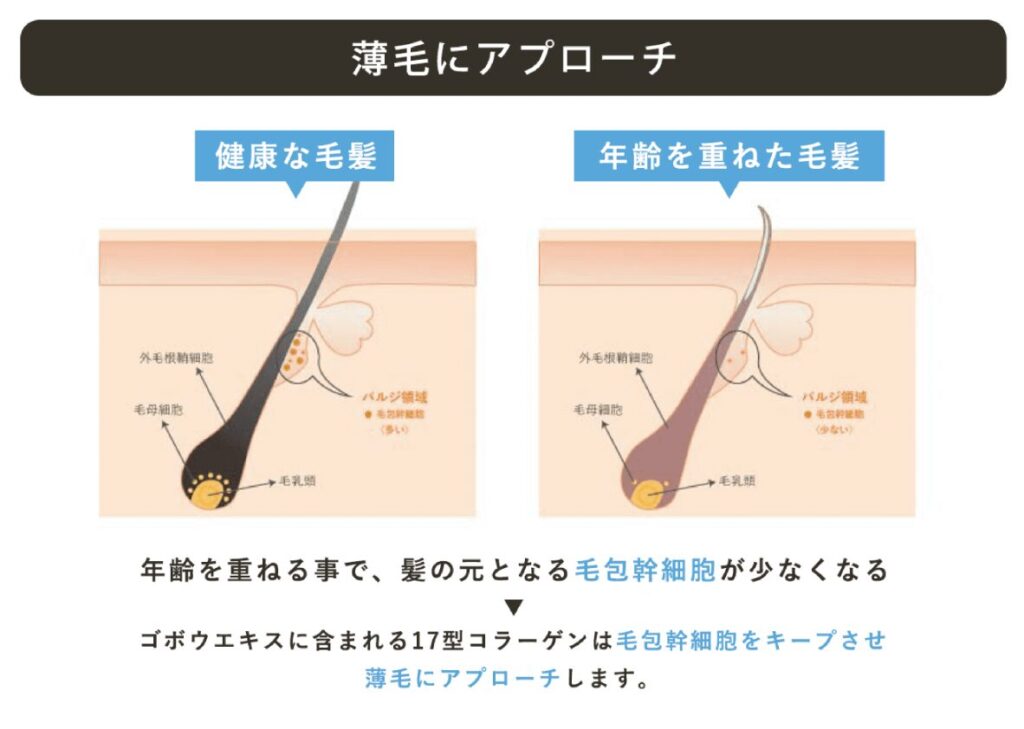 女性用育毛剤ラミナスをおすすめする人